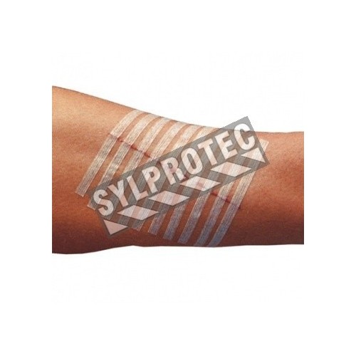 3M Steri-Strip skin closure bandages, 250/box.